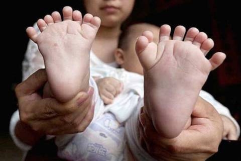 Tác động của ô nhiễm môi trường đến sức khoẻ trẻ em