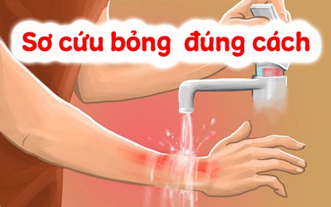 HƯỚNG DẪN SƠ CỨU BỎNG NHIỆT ĐÚNG CÁCH