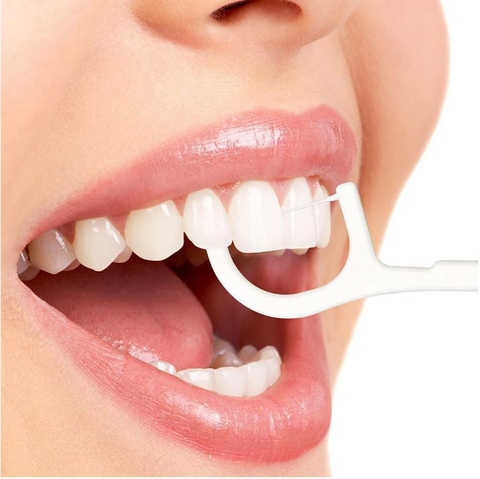 Chỉ nha khoa Dentfine (101 pcs)