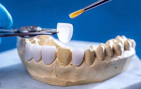 Chương Trình Đào Tạo Kỹ Thuật Phục Hình Răng Tiên Tiến Tại Trung Cấp Y Khoa Việt Nam!