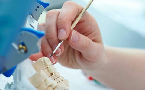 Học Kỹ Thuật Phục Hình Răng Có Khó Không?