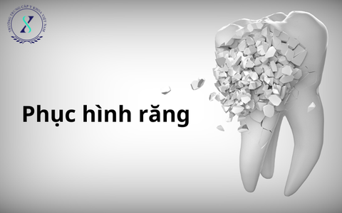 Vì Sao Cần Phục Hình Răng Khi Răng Bị Mất