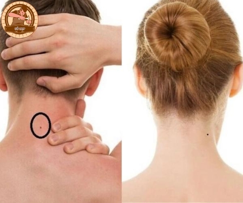 Người có nốt ruồi ở gáy dự báo điềm gì? Tốt hay xấu?