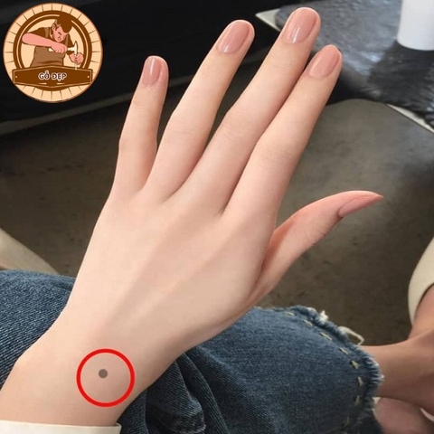 Nốt ruồi cổ tay nam và nữ nói lên điều gì? Có nên tẩy không?