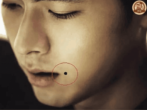 Nốt ruồi xung quanh miệng là “Hung” hay “Cát”? Nên tẩy hay không?