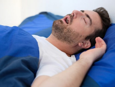 Hội chứng ngừng thở khi ngủ tắc nghẽn (OSA) là gì?