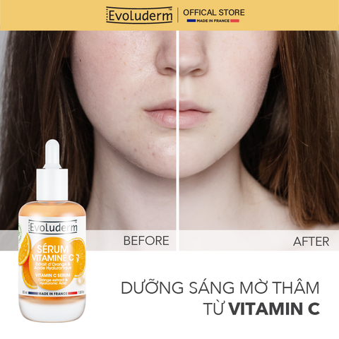 Tinh chất Serum Vitamin C Evoluderm giúp sáng da mờ thâm, dưỡng da mịn màng tươi sáng 30ml