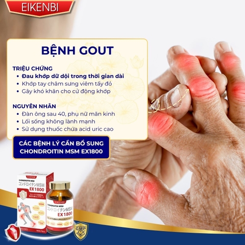 Viên Uống Bổ Xương Khớp Sụn Cá Mập Cao Cấp Chondroitin MSM EX1800 [180 viên]