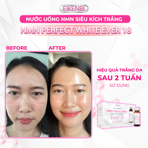 Nước Uống NMN Siêu Kích Trắng - NMN Perfect White Ever 18 [Hộp 10 chai x 30ml]