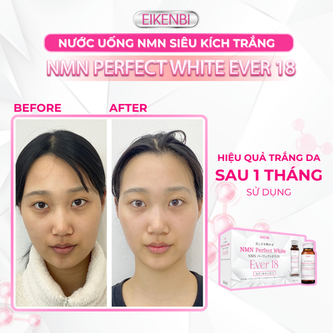 Nước Uống NMN Siêu Kích Trắng - NMN Perfect White Ever 18 [Hộp 10 chai x 30ml]