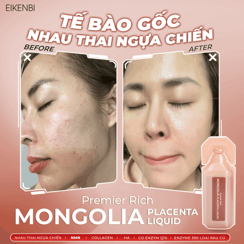 Nước Uống Nhau Thai Ngựa Chiến Mongolia Placenta Liquid Eikenbi [Hộp 30 ống 10ml]