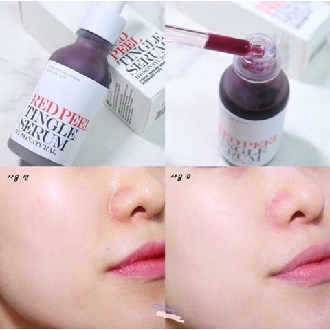 Serum So’Natural Red Peel 11ml