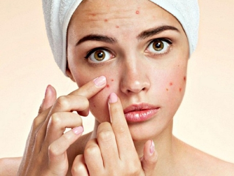 NHỮNG LƯU Ý KHI SỬ DỤNG THUỐC TÂY Y CHỮA MỤN 