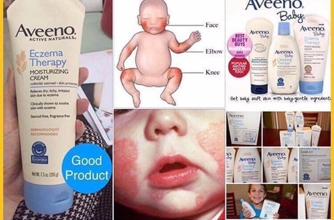 Kem chàm Aveeno Baby Eczema 141gr cho bé