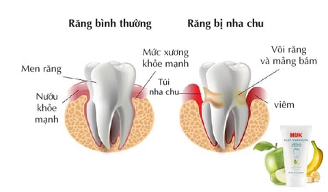 Kem đánh răng trẻ em 3-36 tháng không Flouride 50ml Nuk Đức