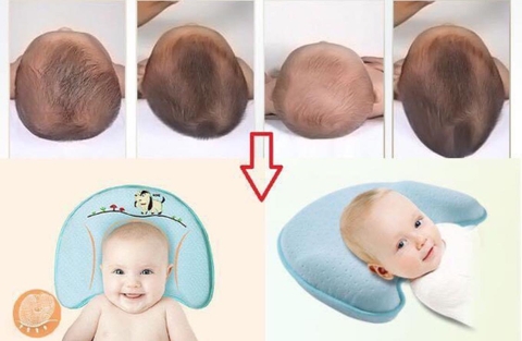 GỐI CHỐNG MÉO ĐẦU BABY MOOV