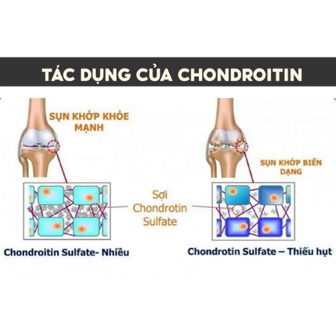 Bổ khớp Glucosamine giúp xương chắc khỏe Glucosamine & Chondroitin 280 viên Kirkland Signature đẩy lùi bệnh viêm khớp, thoái hóa