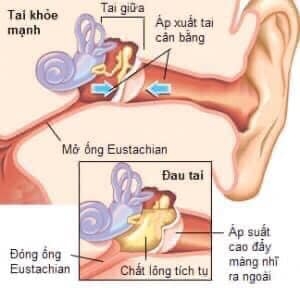 Xịt Tan Ráy Tai CLEANEARS KIDS ÚC 2Tháng-3 Tuổi