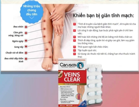 Kem Bôi Giãn Tĩnh Mạch Carusos Veins Care Cream 75Gr Của Úc