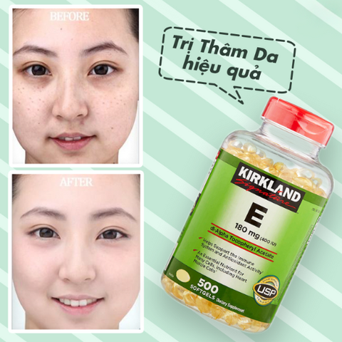 Viên Uống Đẹp Da Kirkland Signature Vitamin E 400IU (500 viên) Mỹ