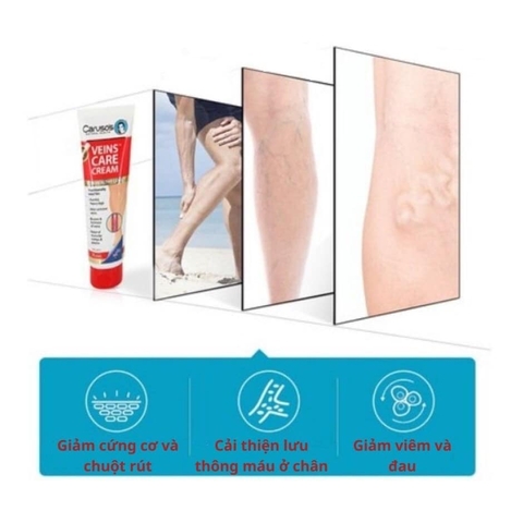 Kem Bôi Giãn Tĩnh Mạch Carusos Veins Care Cream 75Gr Của Úc