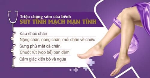 Kem Bôi Giãn Tĩnh Mạch Carusos Veins Care Cream 75Gr Của Úc