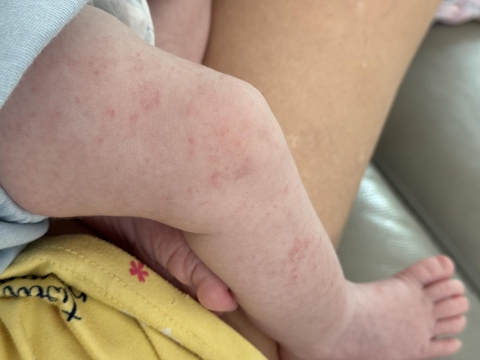 Sữa Công Thức Pepticate Dành Cho Trẻ Sơ Sinh 2026 – Pepticate Hypoallergenic Không Đạm Sữa Bò Không Lactose An Toàn Tăng Cân Hỗ Trợ Tiêu Hóa Miễn Dịch Với DHA ARA Sắt Prebiotics Chính Hãng Mỹ Giá Rẻ Cho Bé Dị Ứng Đạm Sữa Bò