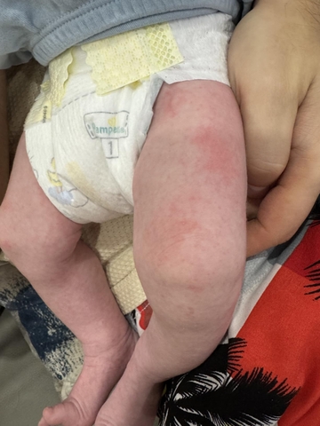 Sữa Công Thức Pepticate Dành Cho Trẻ Sơ Sinh 2026 – Pepticate Hypoallergenic Không Đạm Sữa Bò Không Lactose An Toàn Tăng Cân Hỗ Trợ Tiêu Hóa Miễn Dịch Với DHA ARA Sắt Prebiotics Chính Hãng Mỹ Giá Rẻ Cho Bé Dị Ứng Đạm Sữa Bò