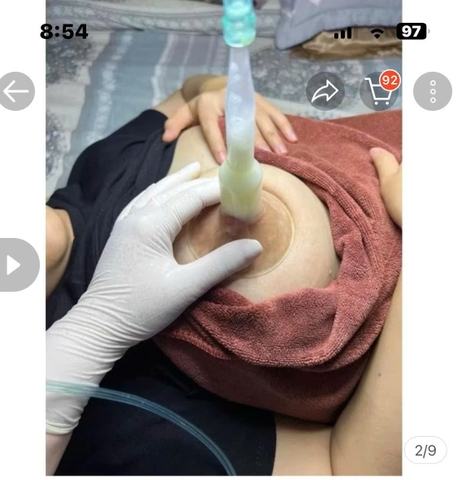 Máy Massage Thông Tắc Tia Sữa M364A Chính Hãng RADIUM 2025: Review Chi Tiết, Giá Bán, Thông Số Kỹ Thuật, Lợi Ích, Cách Sử Dụng Cho Mẹ Sau Sinh