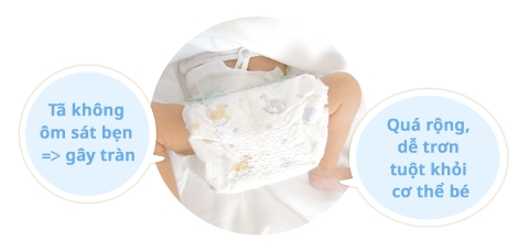 Tã Dán Moony Cho Trẻ Sinh Non Dưới 3kg 30 Miếng – Tã Siêu Mỏng, Thấm Hút 12h, Chống Hăm, Da Nhạy Cảm, Nhập Khẩu Nhật Bản