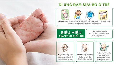 Sữa Gạo Novalac Riz AR Chính Hãng 2025: Review Chi Tiết, Giá Bán, Thành Phần, Lợi Ích, Cách Pha Cho Bé Dị Ứng Đạm Sữa Bò, Không Dung Nạp Lactose, Trào Ngược Nôn Trớ