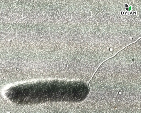 Bệnh nhiễm trùng do vi khuẩn Aeromonas ở thuỷ sản