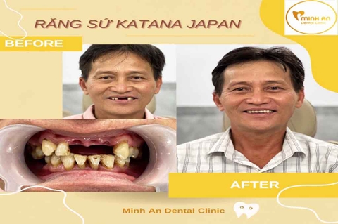 Làm Răng Đẹp Đà Nẵng