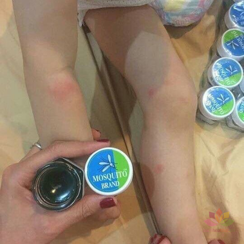 Dầu Thoa Trị Muỗi Đốt Mosquito Balm Thái Lan