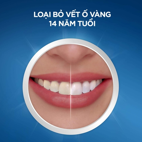 Miếng dán làm trắng răng Crest 3D Whitestrips Professional Effects