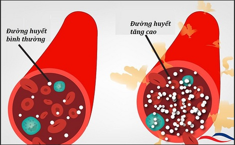 5 thức uống làm đường huyết tăng nhanh