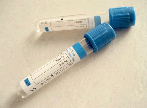 Ống nghiệm Citrate