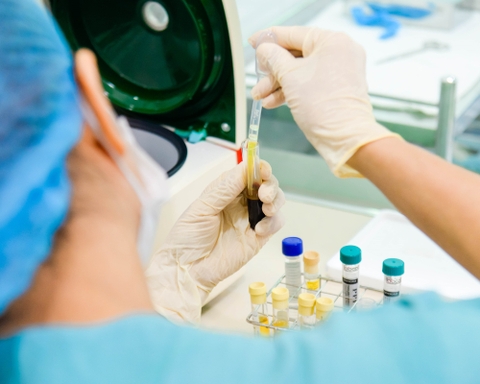 Công nghệ tách chiết PRP