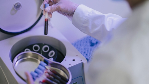 Những nghiên cứu ứng dụng huyết tương giàu tiểu cầu tự thân trong trị liệu