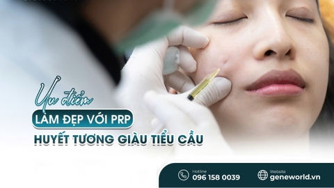 Phương pháp tiêm huyết tương giàu tiểu cầu trong điều trị trẻ hóa da