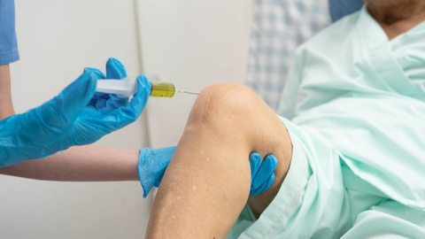 Bao lâu tiêm PRP 1 lần để tối ưu hiệu quả điều trị?