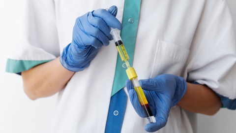 Sai lầm thường gặp khi tiêm PRP huyết tương giàu tiểu cầu