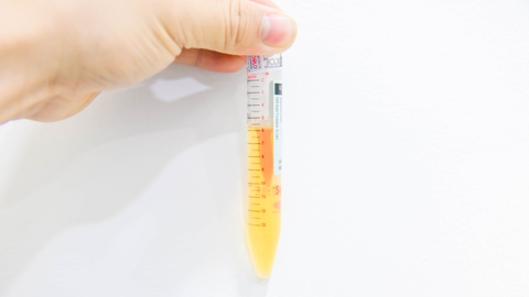 PRP là gì? Điểm nổi bật giúp phương pháp này được khuyên chọn hàng đầu