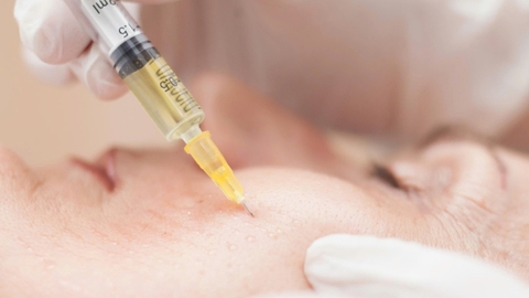 PRP (Platelet Rich Plasma): Khái niệm, cơ chế và ứng dụng trong trị liệu