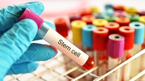 Tế bào gốc lấy từ đâu? Nguồn tế bào gốc phổ biến trong điều trị hiện nay