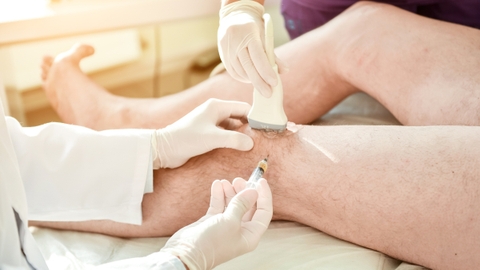 Hiệu quả tiêm huyết tương giàu tiểu cầu khớp gối điều trị thoái hóa, chấn thương