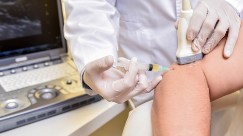 Tiêm huyết tương giàu tiểu cầu khớp vai điều trị thoái hóa khớp vai