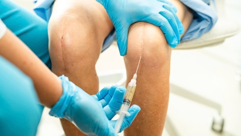 Vai trò của tiêm huyết tương giàu tiểu cầu trong điều trị bảo tồn khớp