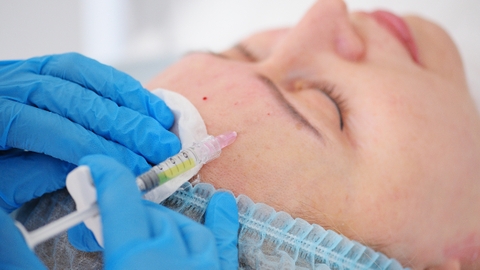 Tiêm prp bao lâu có tác dụng? Lưu ý gì sau tiêm PRP da mặt?