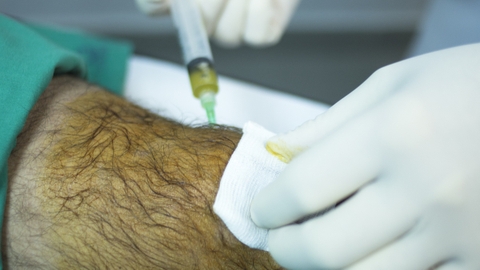 Chi phí tiêm prp khớp gối giá bao nhiều? Liệu trình gồm mấy mũi?